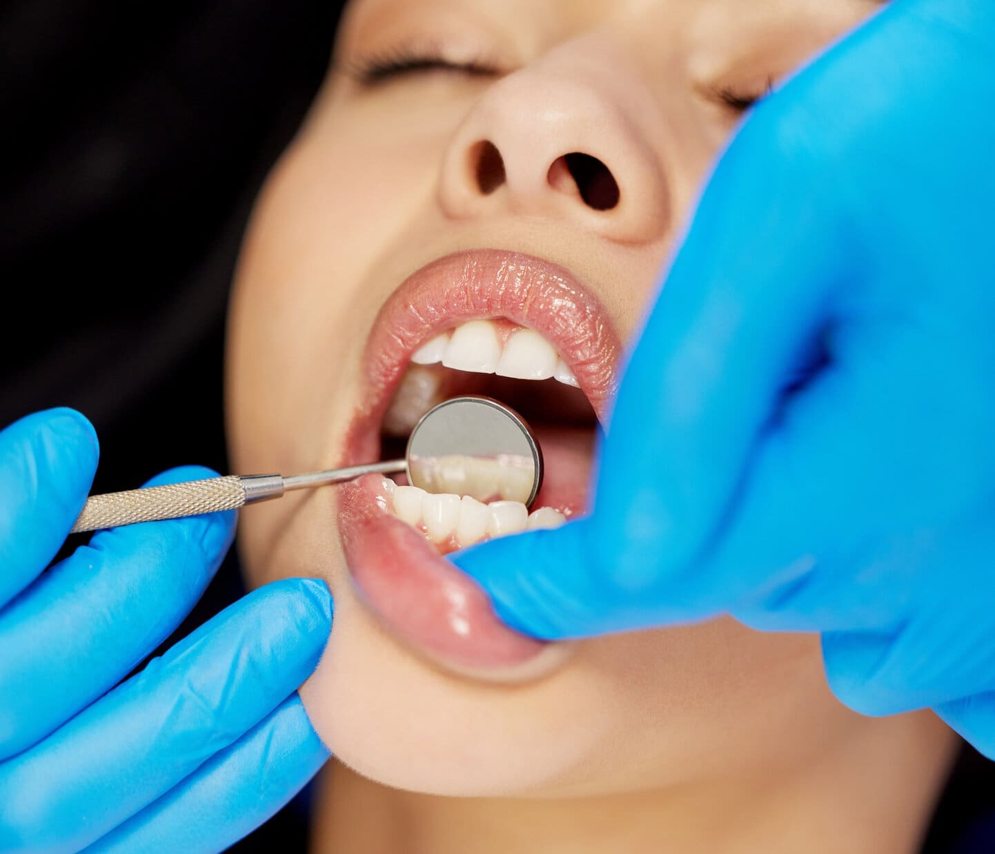 What You Need To Know When Recovering From Laser Gum Surgery 