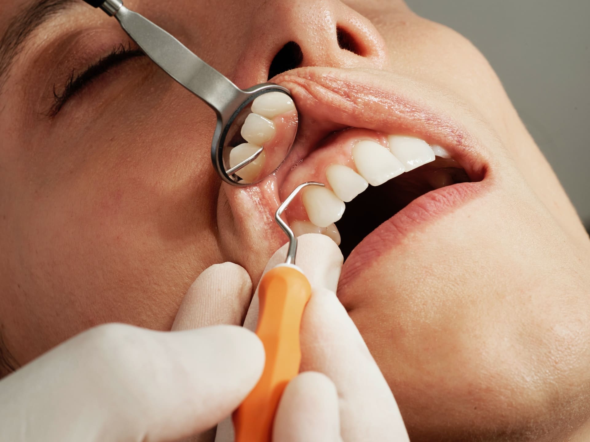 Close up of a dental patient receiving treatment