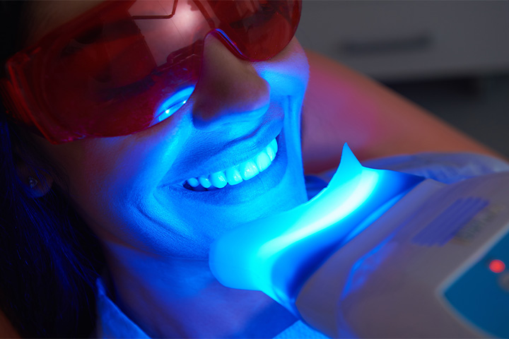 An adult woman receiving an in-office teeth whitening treatment