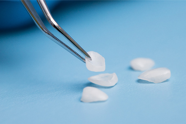Tweezers holding a veneer against a background of lying veneers