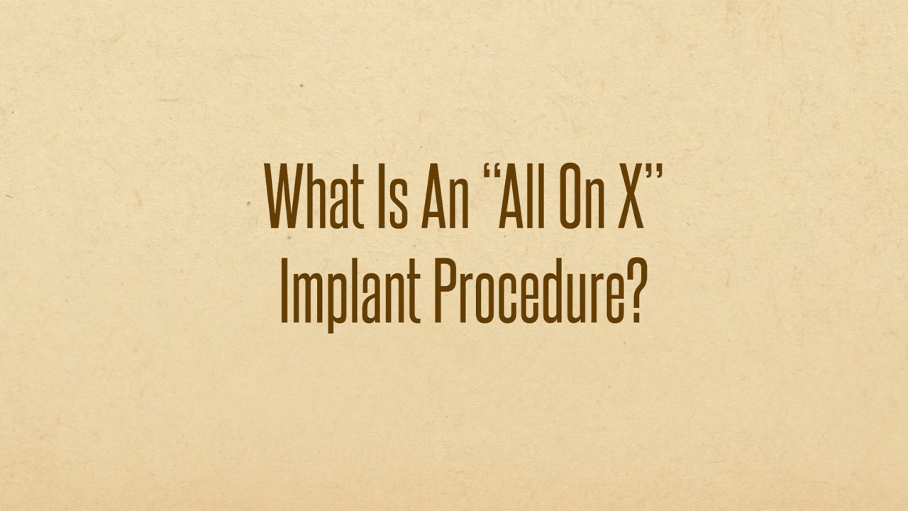 YouTube thumbnail of FAQ by Doctor William Negreiros about an All-on-X implant procedure.