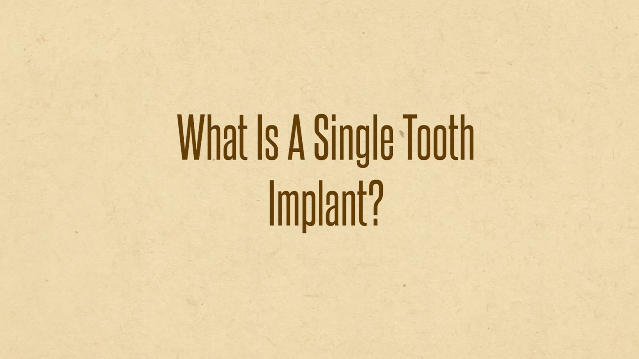 YouTube thumbnail of FAQ by Doctor William Negreiros about a single tooth implant.