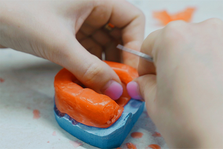 A dental technician creating a wax mold.