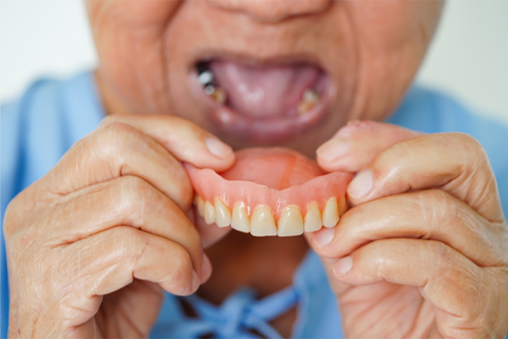 An older person removing dentures from their mouth.