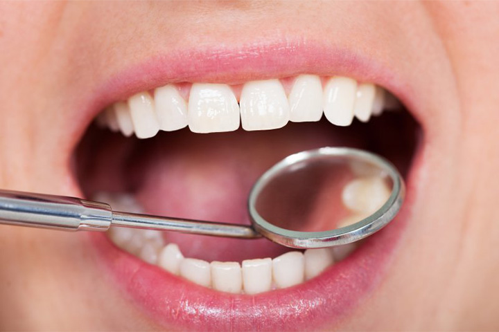 Mouth examined with dental mirror.